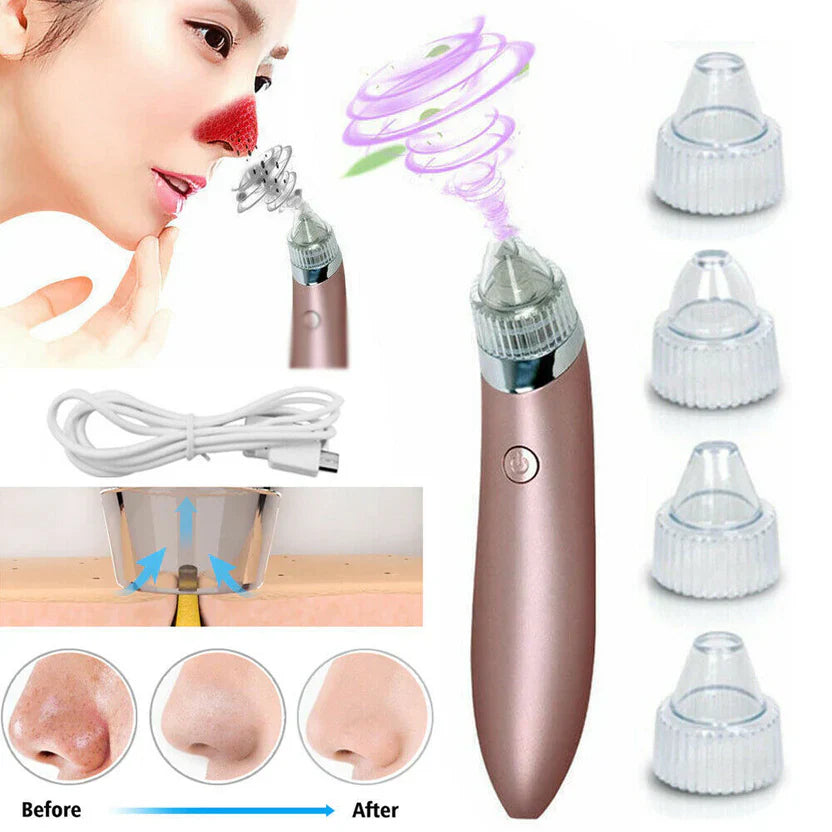 Chargeable Blackhead Removal Machine
