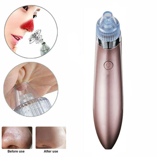 Chargeable Blackhead Removal Machine